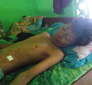Diduga Aniaya Remaja Tanpa Sebab, “Tuan Takur” Warga Desa Sumberejo Dilaporkan ke Polsek Banyu Putih