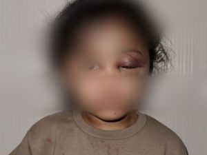 Bocah 3 Tahun Anak Selebgram Asal Malang Diduga Disiksa oleh Susternya